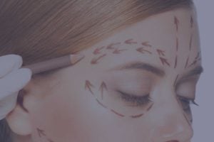 Eye Procedures