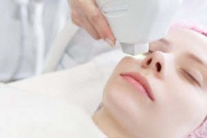 Acne Scar Laser Surgery