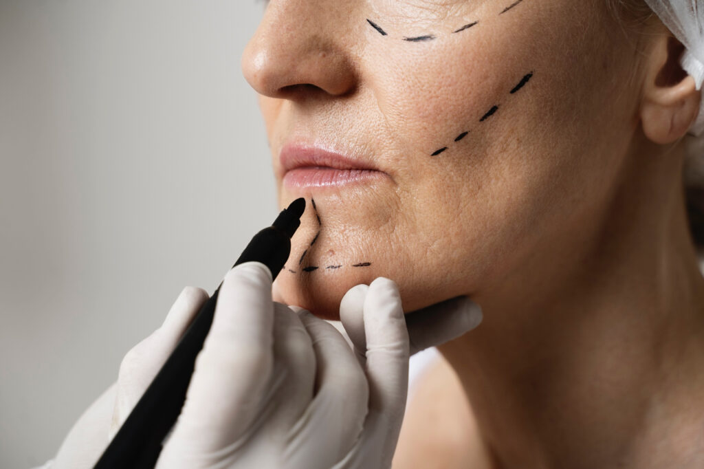 Chadwell Facial Plastics - Woman Being Evaluated For Plastic Surgery