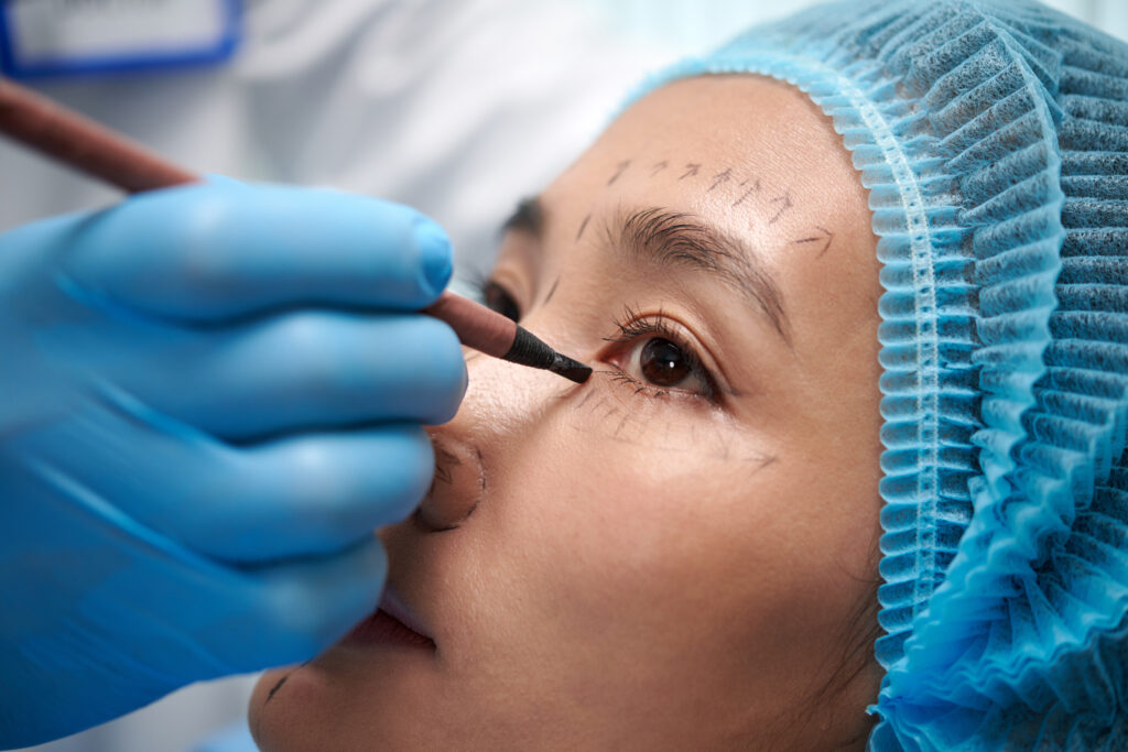 Closeup image of young woman getting face marked before blepharoplasty