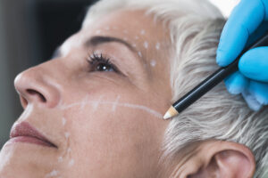 Anti-Aging Concept. Doctor's hand in blue surgical glove marking senior women's face for cosmetic injections.